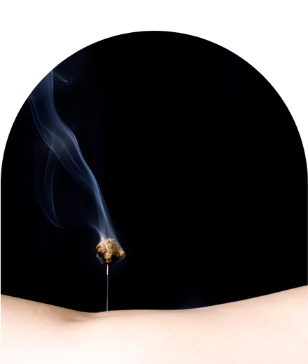 Moxibustion